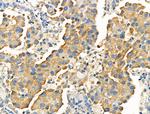 SLC15A1 Antibody in Immunohistochemistry (Paraffin) (IHC (P))