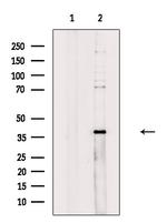 ZDHHC15 Antibody in Western Blot (WB)