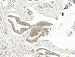 EHHADH Antibody in Immunohistochemistry (Paraffin) (IHC (P))