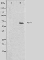 KV1.5 (KCNA5) Antibody in Western Blot (WB)