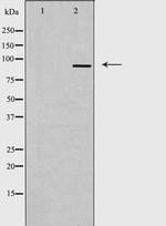 Gemin 3 Antibody in Western Blot (WB)