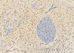 SSH3 Antibody in Immunohistochemistry (Paraffin) (IHC (P))