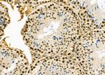 SSH3 Antibody in Immunohistochemistry (Paraffin) (IHC (P))