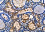 S100A5 Antibody in Immunohistochemistry (Paraffin) (IHC (P))