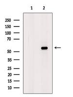 S100A5 Antibody in Western Blot (WB)