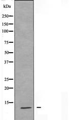 S100A7L2 Antibody in Western Blot (WB)