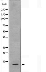 S100Z Antibody in Western Blot (WB)