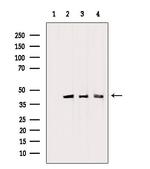 PDHA1 Antibody in Western Blot (WB)