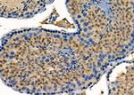 RABEP2 Antibody in Immunohistochemistry (Paraffin) (IHC (P))