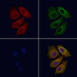 Radixin Antibody in Immunocytochemistry (ICC/IF)