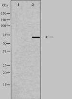 Radixin Antibody in Western Blot (WB)