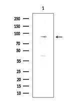 RASA3 Antibody in Western Blot (WB)