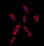 RAB20 Antibody in Immunocytochemistry (ICC/IF)