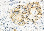 RAB20 Antibody in Immunohistochemistry (Paraffin) (IHC (P))