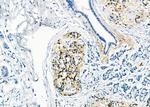 RAB20 Antibody in Immunohistochemistry (Paraffin) (IHC (P))