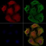 RAB37 Antibody in Immunocytochemistry (ICC/IF)