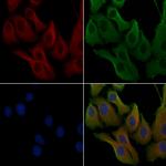 RAB5C Antibody in Immunocytochemistry (ICC/IF)