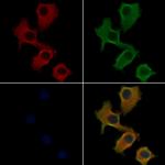 RAB6C Antibody in Immunocytochemistry (ICC/IF)