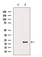 RGS5 Antibody in Western Blot (WB)