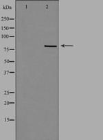 RFWD3 Antibody in Western Blot (WB)