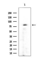 RFWD3 Antibody in Western Blot (WB)