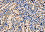 SPINK5 Antibody in Immunohistochemistry (Paraffin) (IHC (P))