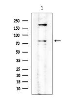 PLK2 Antibody in Western Blot (WB)