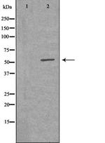 VRK2 Antibody in Western Blot (WB)