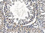 SHANK2 Antibody in Immunohistochemistry (Paraffin) (IHC (P))