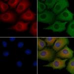 SH3GL2 Antibody in Immunocytochemistry (ICC/IF)