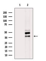 SH3GL2 Antibody in Western Blot (WB)