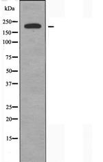 SCN4A Antibody in Western Blot (WB)