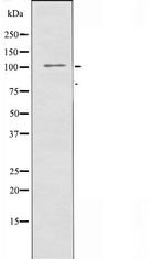 ATP1A2 Antibody in Western Blot (WB)