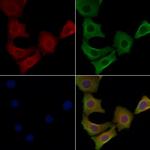 STMN4 Antibody in Immunocytochemistry (ICC/IF)