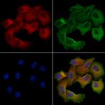 TCP-1 epsilon Antibody in Immunocytochemistry (ICC/IF)