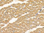 TCP-1 epsilon Antibody in Immunohistochemistry (Paraffin) (IHC (P))