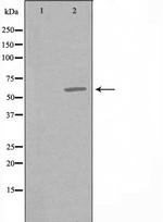 CCT6A Antibody in Western Blot (WB)
