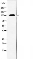 TAF3 Antibody in Western Blot (WB)