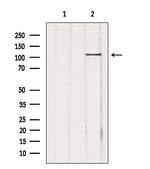 USP11 Antibody in Western Blot (WB)