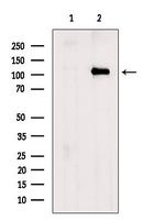 USP15 Antibody in Western Blot (WB)