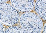 ATP6V1C2 Antibody in Immunohistochemistry (Paraffin) (IHC (P))