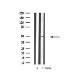 ATP6V1C2 Antibody in Western Blot (WB)