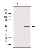 ATP6V1C2 Antibody in Western Blot (WB)