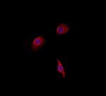 WAVE2 Antibody in Immunocytochemistry (ICC/IF)