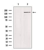 ZC3H13 Antibody in Western Blot (WB)