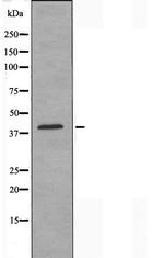 ZC3H8 Antibody in Western Blot (WB)