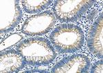 ZFYVE19 Antibody in Immunohistochemistry (Paraffin) (IHC (P))