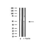 ZFYVE19 Antibody in Western Blot (WB)