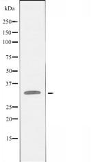 ZNF771 Antibody in Western Blot (WB)