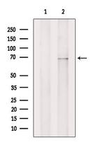 ZIP4 Antibody in Western Blot (WB)